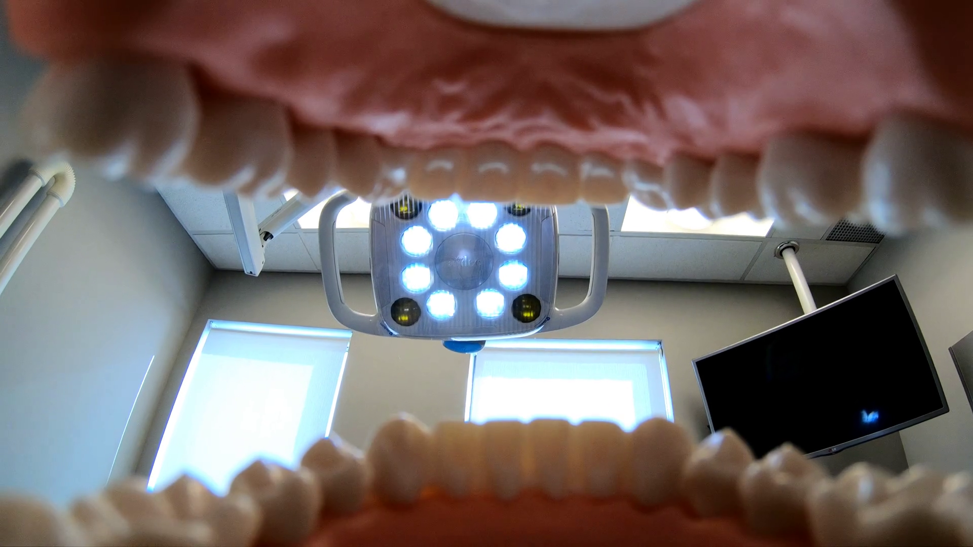 Person Sitting In Dentist Chair Shot From Stock Footage SBV321075563