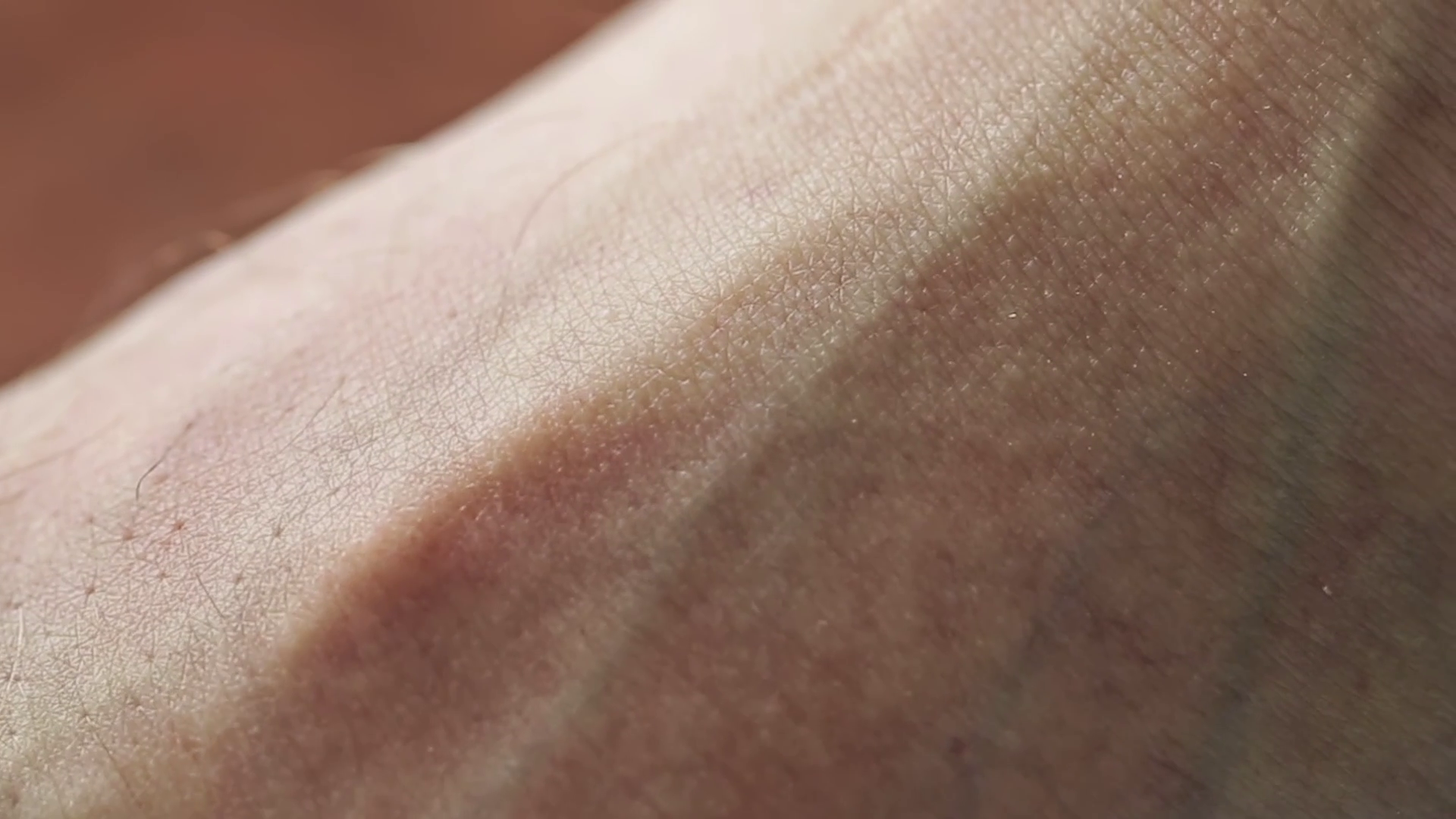 Pulsating Vein Blood Pressure Stock Footage SBV334225383 Storyblocks