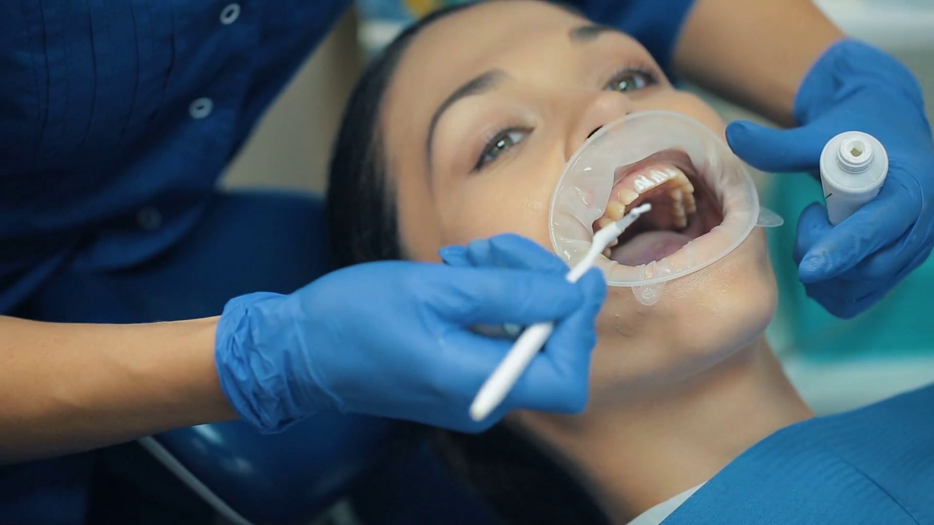 Woman With Rubber Dam In Mouth At Dentist Stock Footage SBV308843360