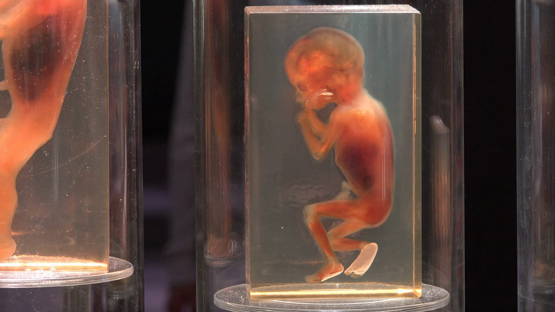Preserved baby fetus on display to show level of development 4k Stock ...