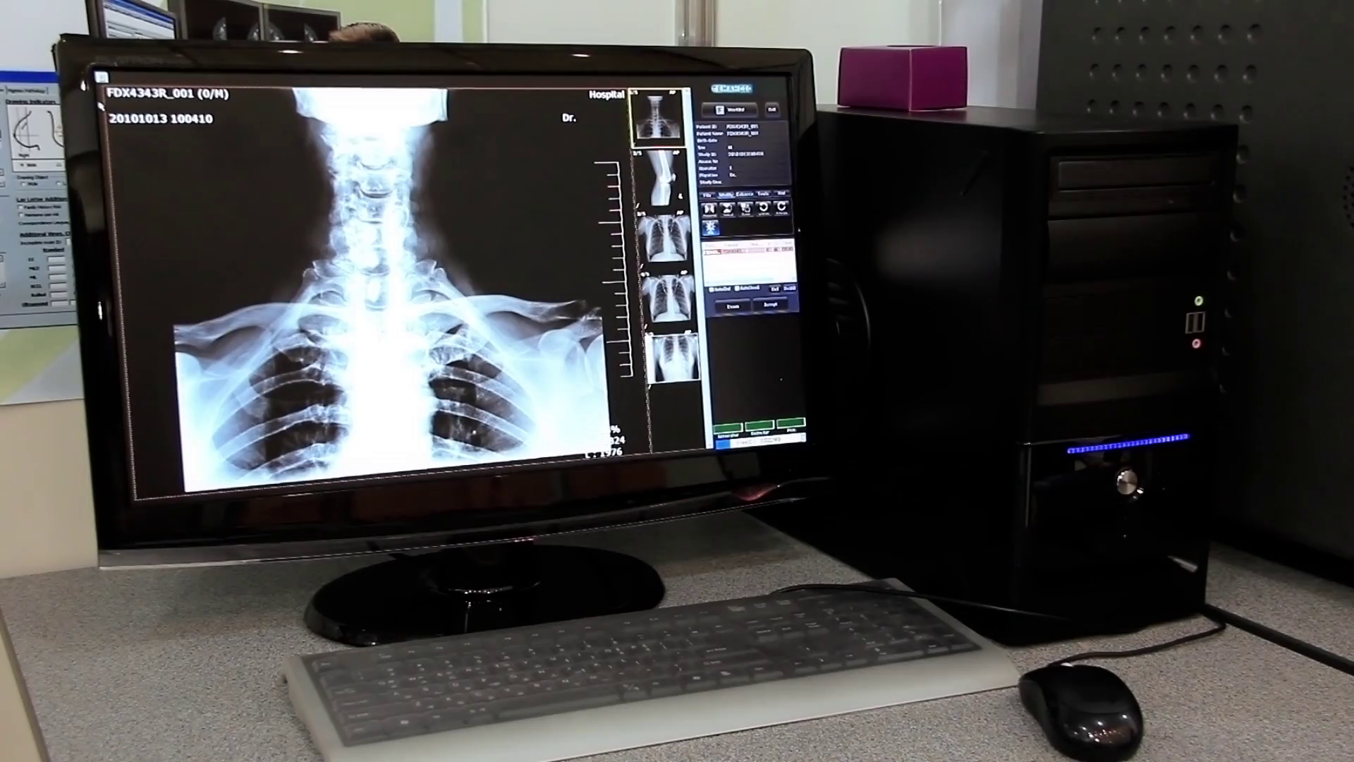 Monitor with xray image in diagnostic laboratory Stock Video Footage