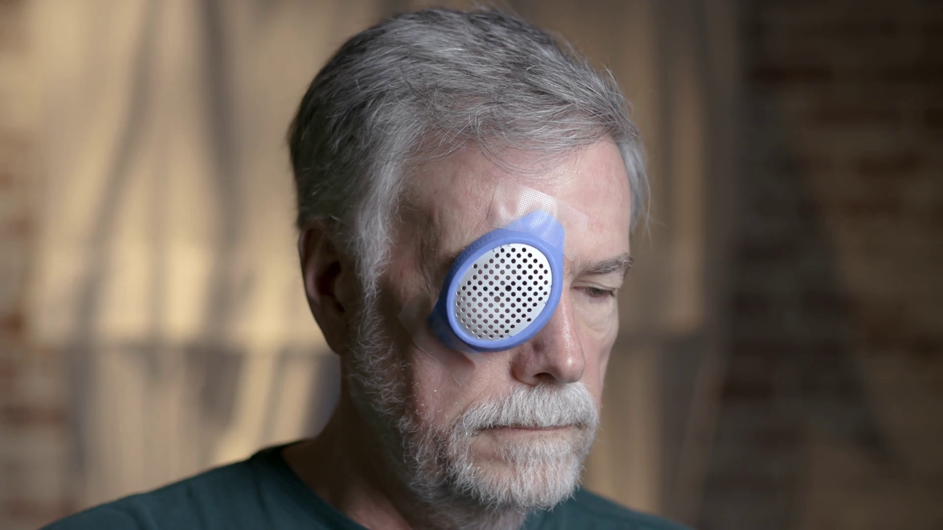 senior man looks sad while wearing an eye shield after cataract surgery