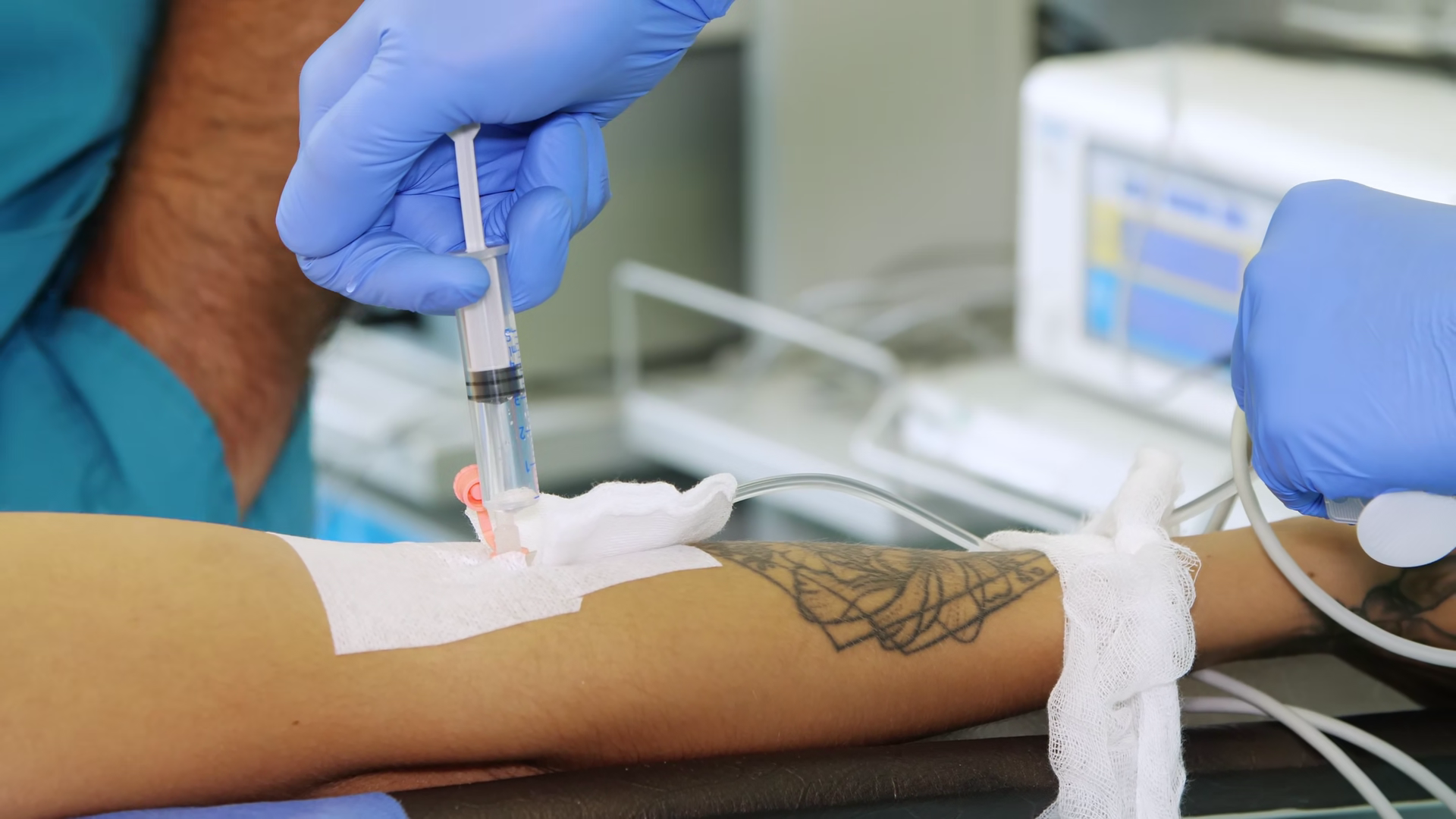 Process Of Intravenous Infusion Of Solutions Stock Footage SBV ...