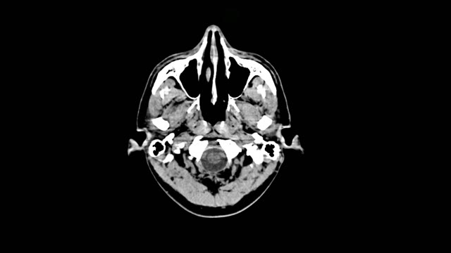 Cat Scan | Technology stock footage - Storyblocks