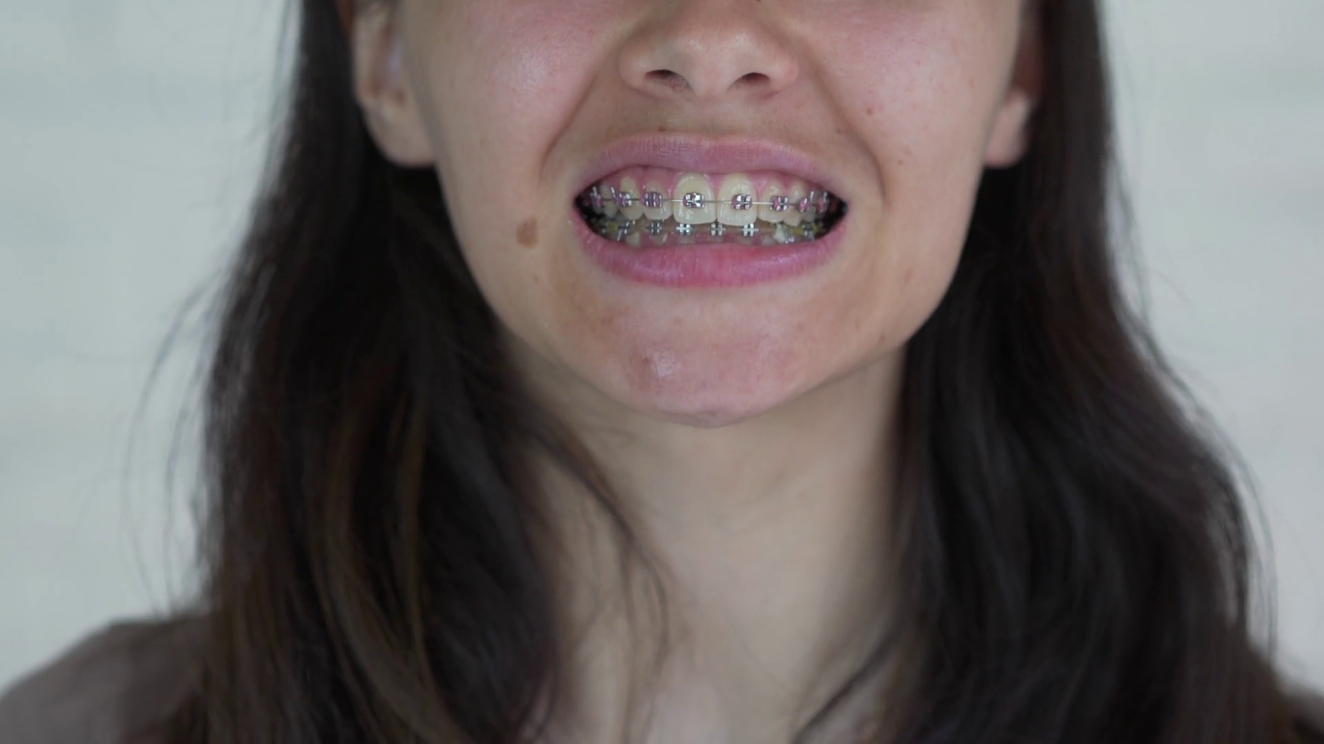 Braces girl from twitter full video