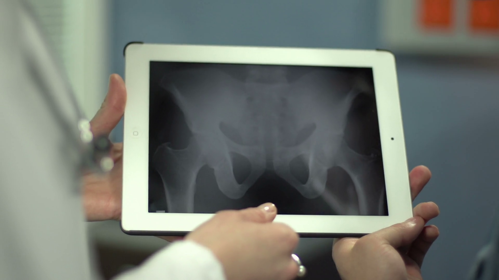 Doctor Showing Patient's Pelvic Area Stock Footage SBV301158670