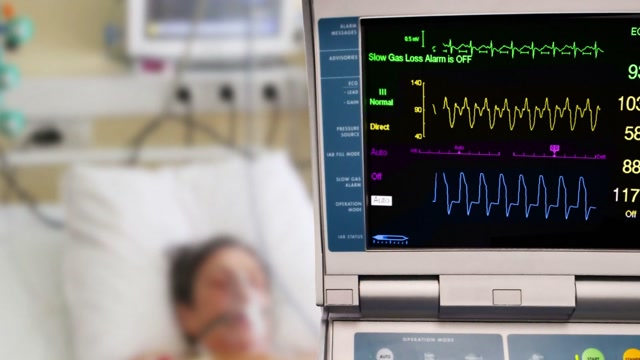 Cardiac Pacemaker Stock Footage: Royalty-Free Video Clips - Storyblocks