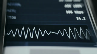 Live data transfer analytics with line graph interface
