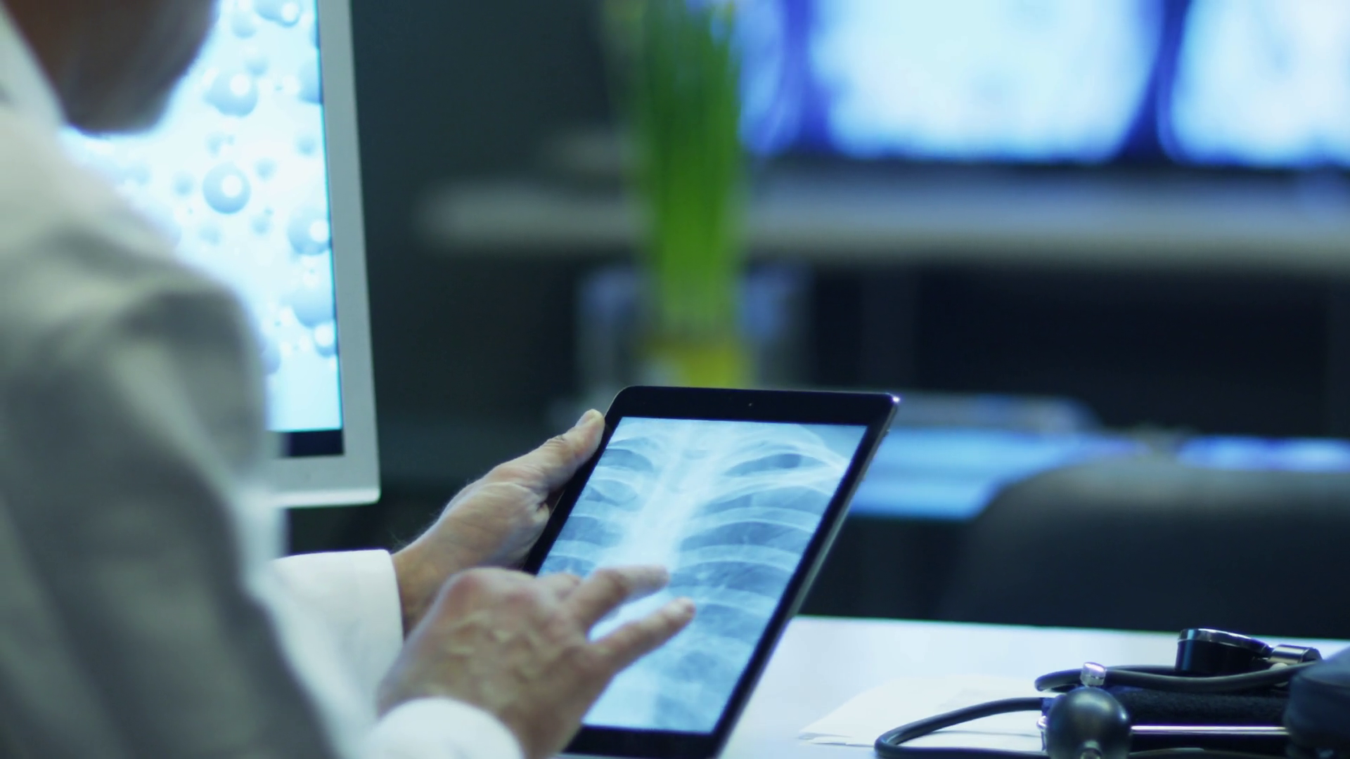 Doctor Is Watching Rib Cage X-ray Pictures Stock Footage SBV-351876542 ...
