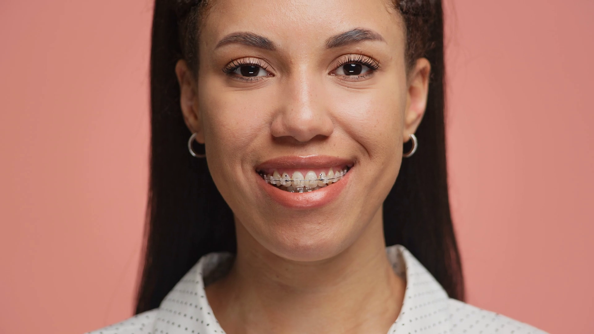 Happy Young Woman Smiling With Braces On Stock Footage SBV-351980457 ...