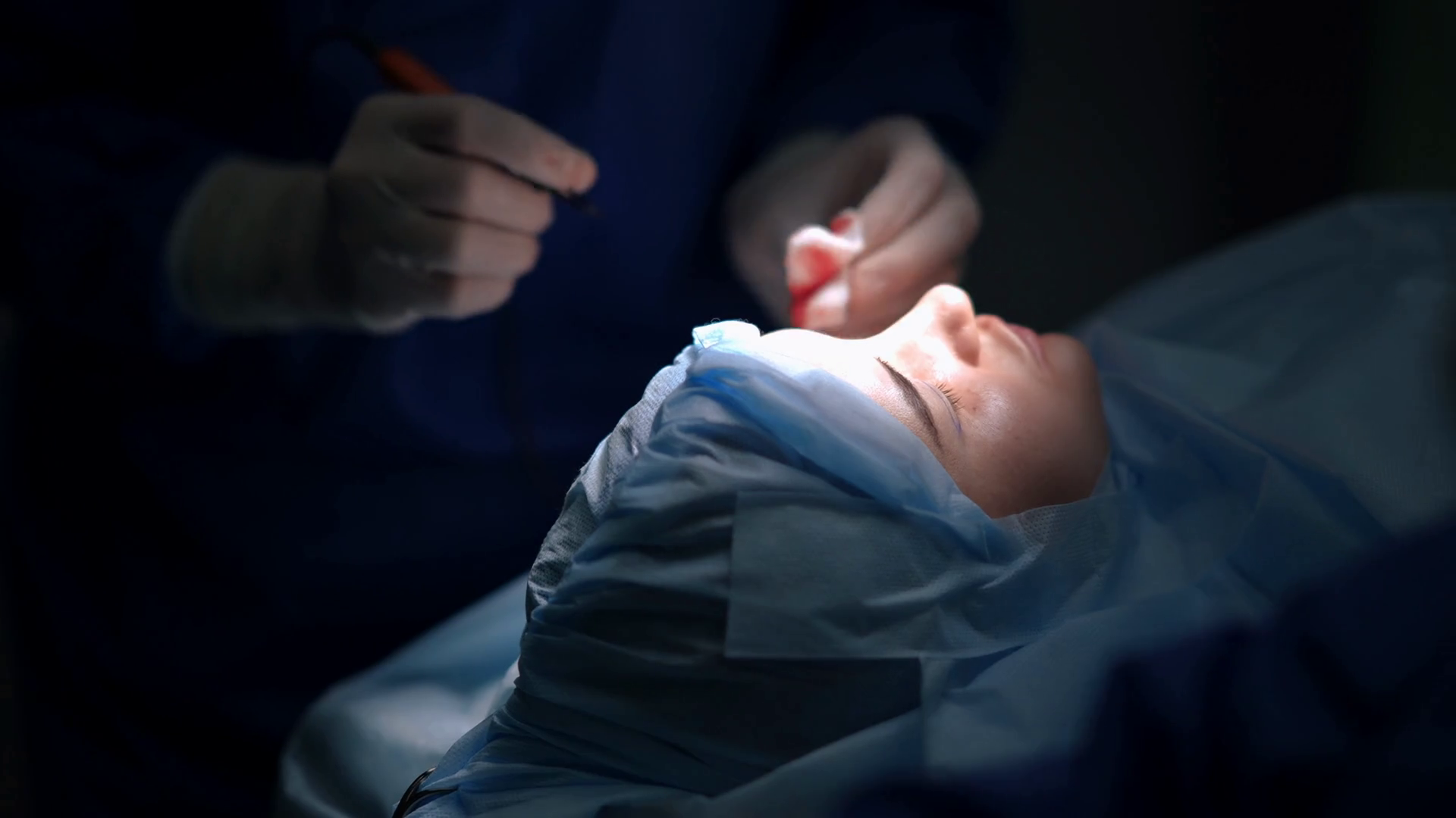 Side View Portrait Of Woman Lying On Surgery Stock Footage SBV