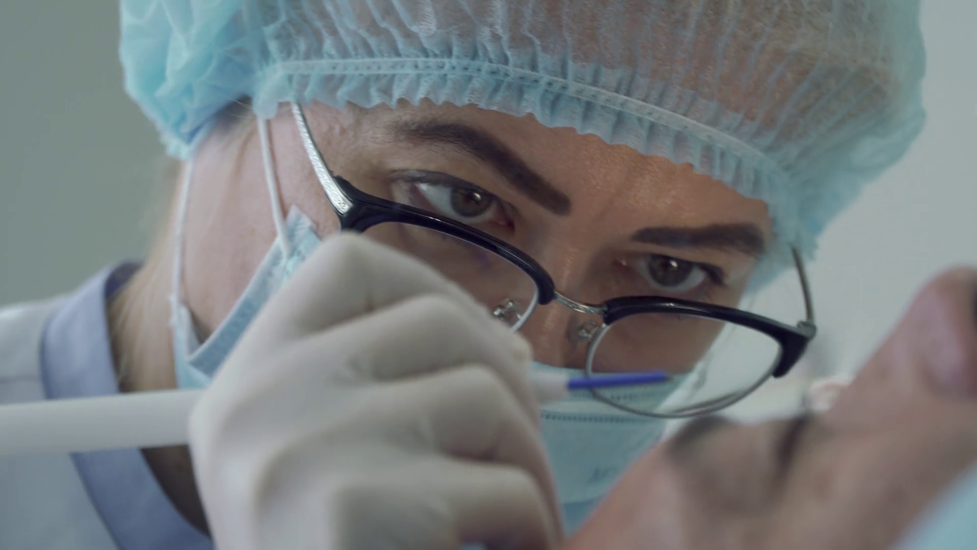 Dermatologist Remove Mole With Laser On The Face Of Man Stock Video Footage 00 17 SBV 325044483 
