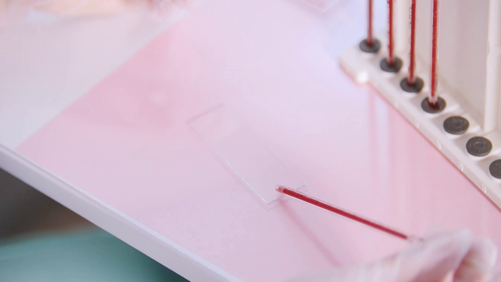 Medical clinic. A blood test. Dripping the blood on the glass and