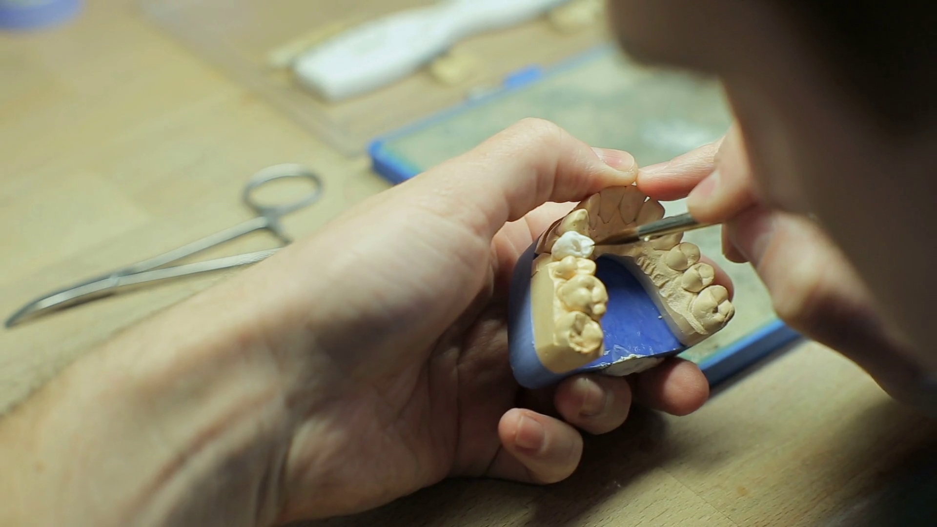 Dental Technician During Mouth Restoration Stock Footage SBV311722219 Storyblocks