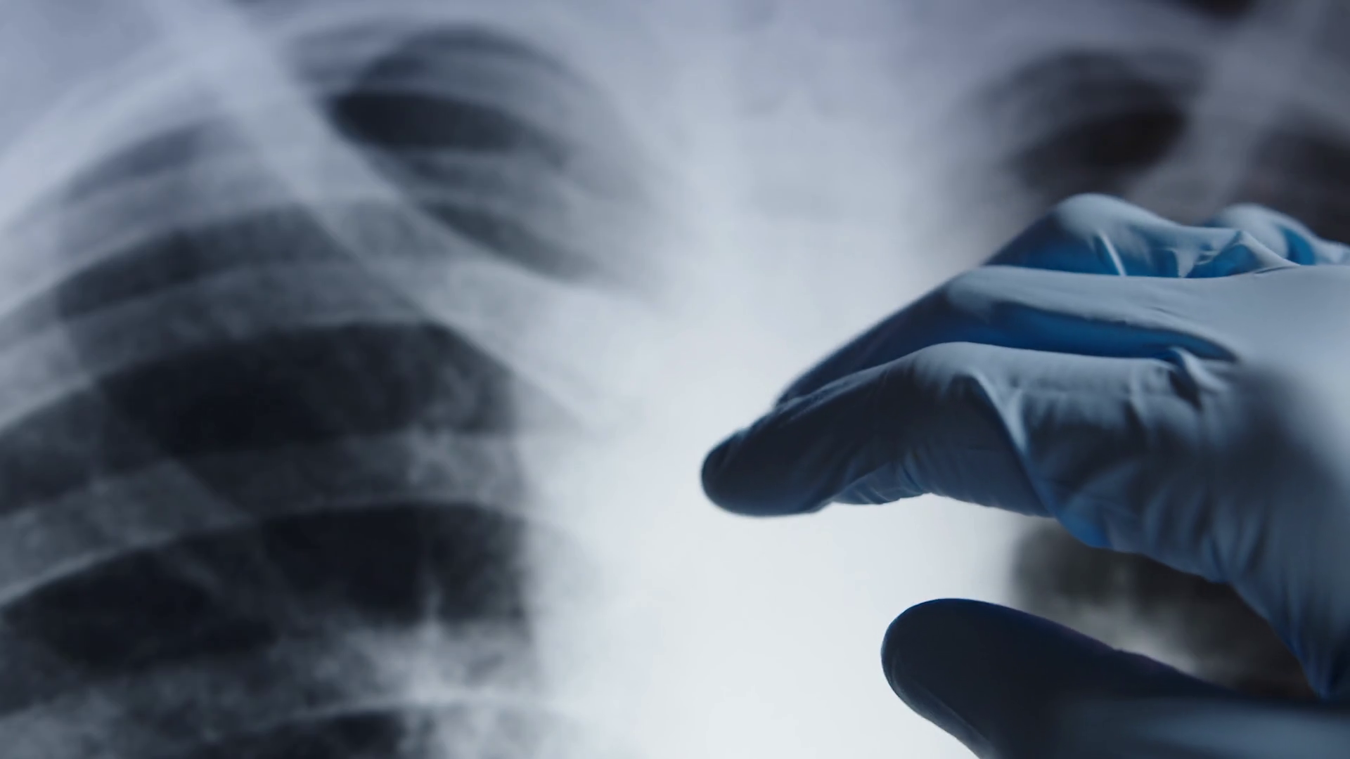 Doctor Examining Xray On Tablet Stock Footage SBV338375563 Storyblocks