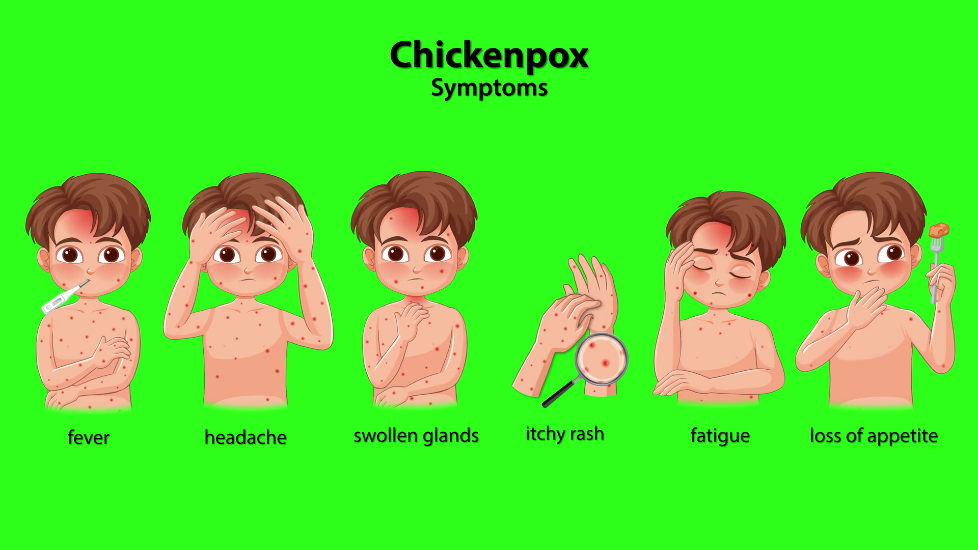 Animated Guide To Chickenpox Symptoms In Stock Footage SBV-352961286 ...