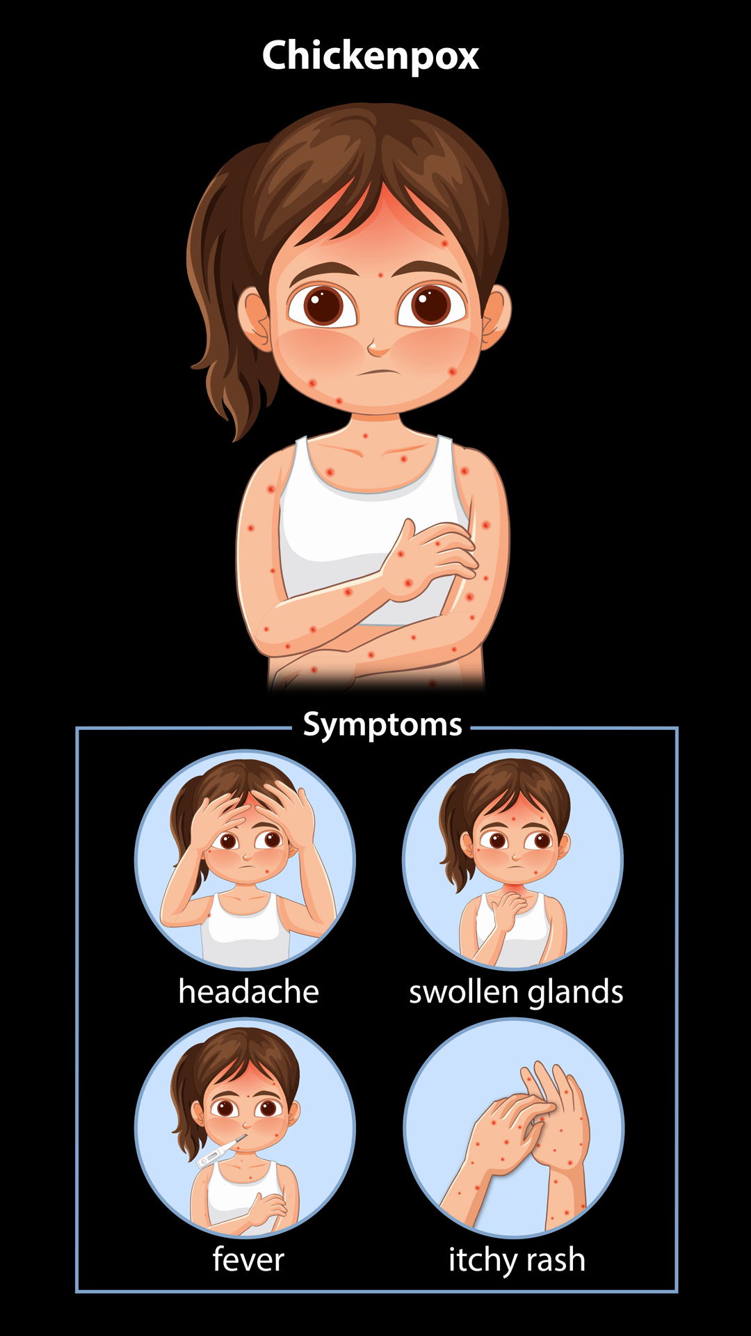 Chickenpox Symptoms Progression In Animated Stock Footage SBV-353137793 ...