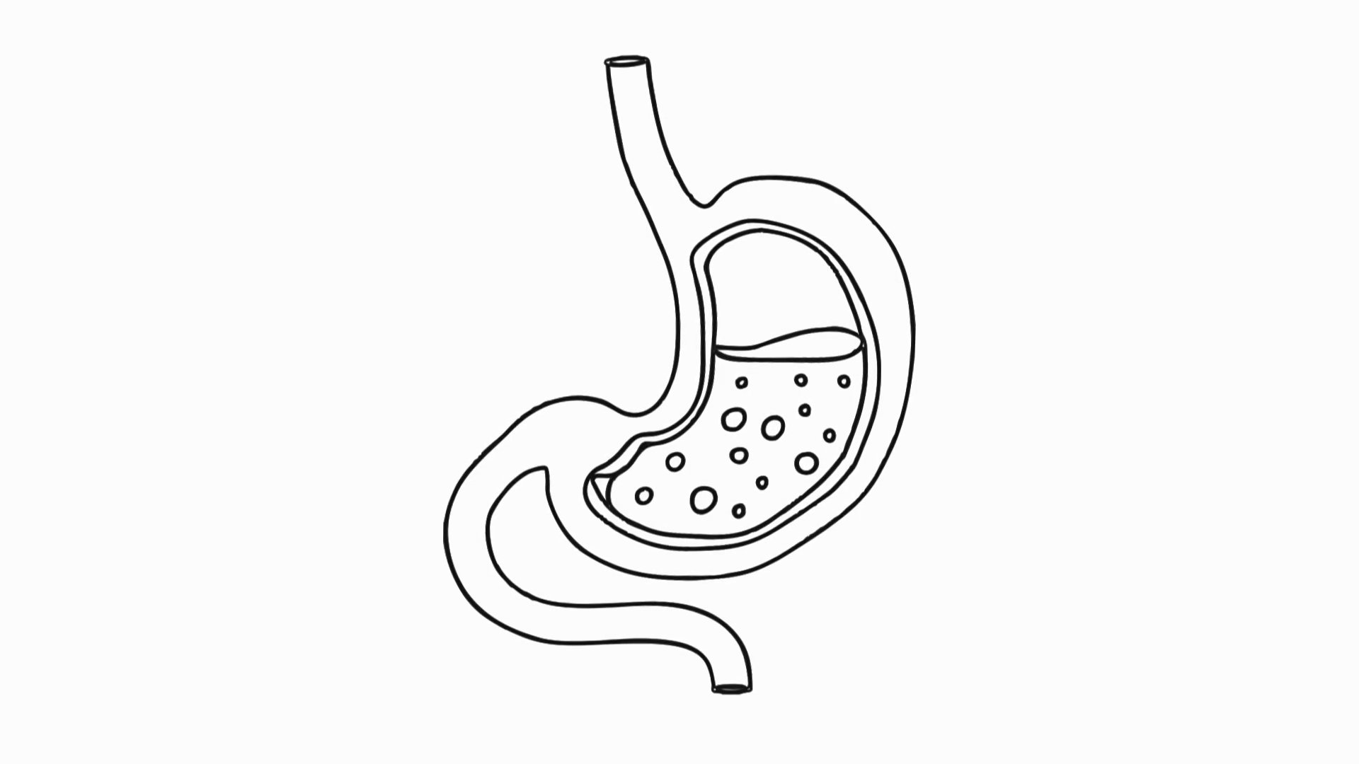 Stomach Acid Reflux Human Body Medical Stock Motion Graphics Sbv