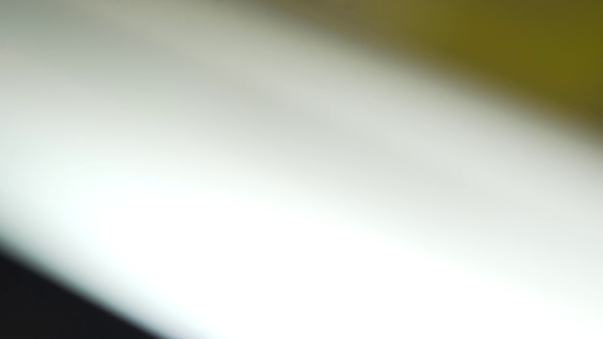 Coronary Stent Is Small Mesh Tube S Used To Stock Footage SBV-348535149 ...