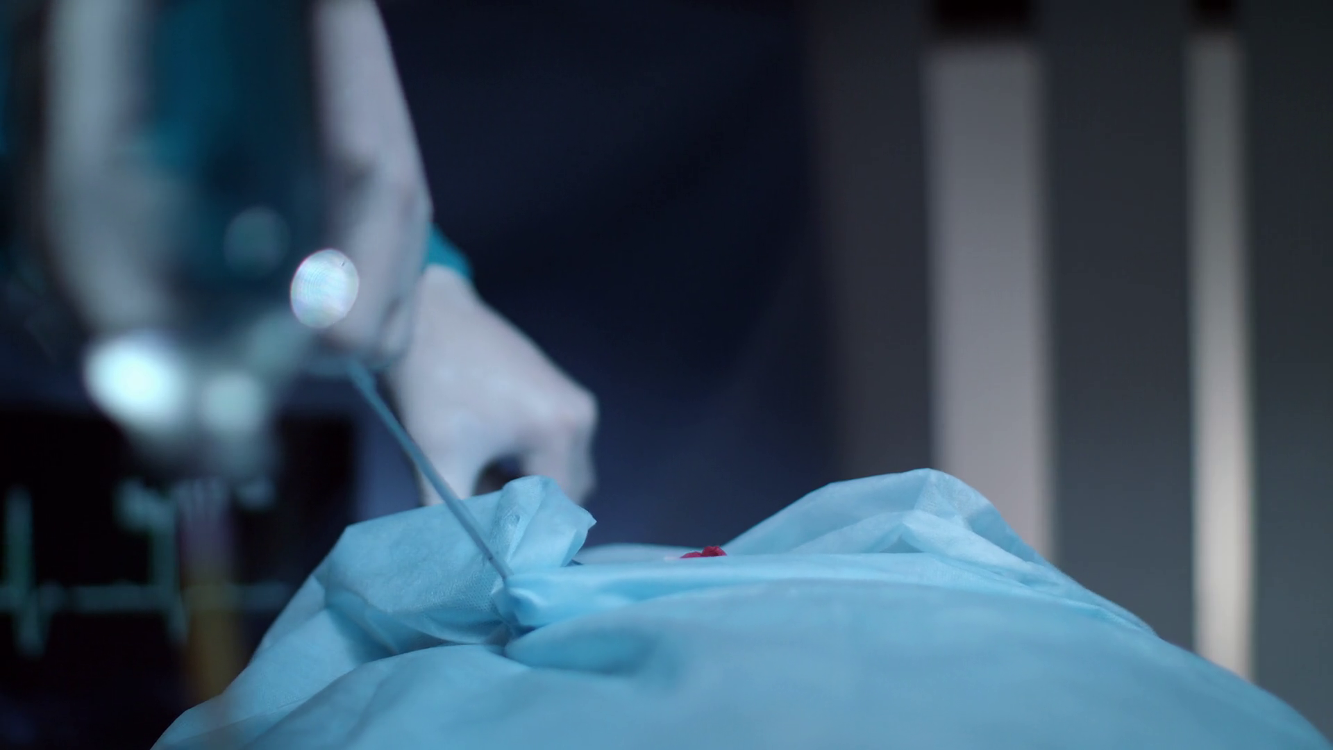 Surgeon patient breath oxygen mask during operation. Point of view patient on medical operation