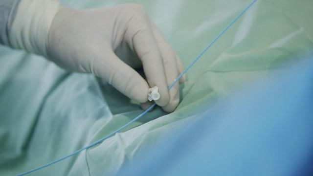 Cath Lab Stock Footage: Royalty-Free Video Clips - Storyblocks