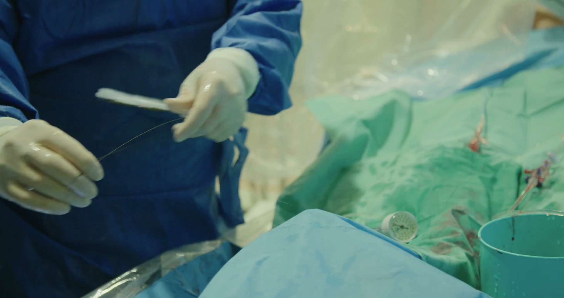 Surgeons Inserting Catheter During Cardiac Stock Footage SBV315869928