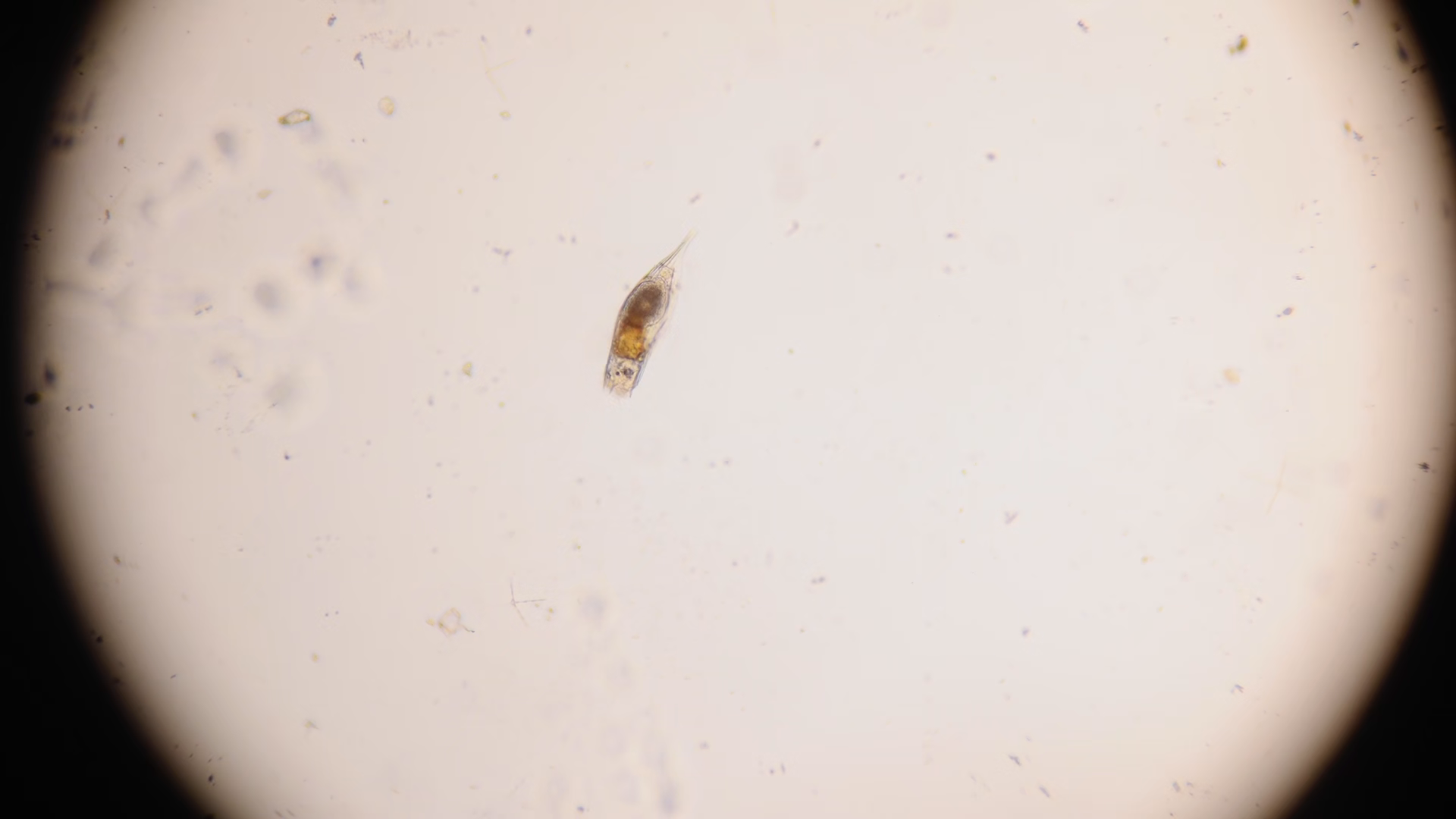 Rotifera Under Microscope Rotifers Are Stock Footage SBV-354011461 ...
