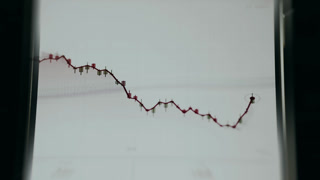 Financial candlestick chart for technical analysis and visualization of price fluctuations