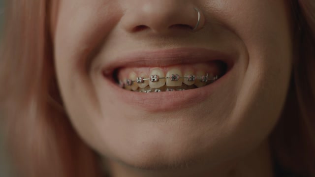 Teeth Animation | People stock footage - Storyblocks