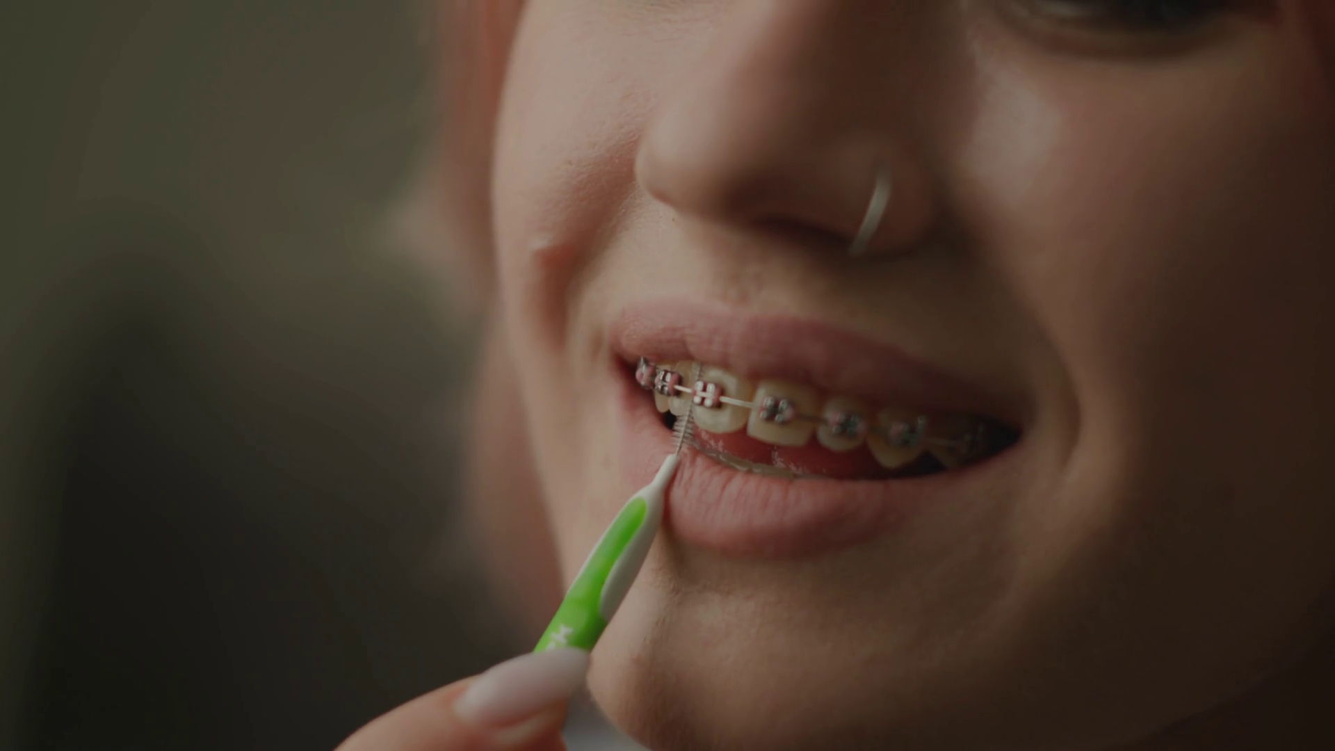 Dental Braces Cleaning Process Woman Stock Footage SBV347644808