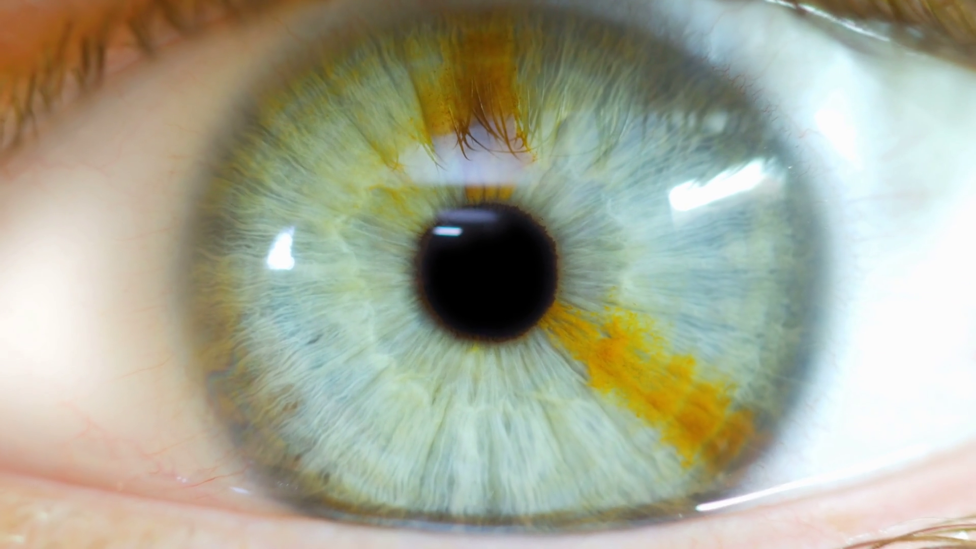 Eye Zoom Into Black Pupil Macro Close Up With Brown Birth Mark Stock