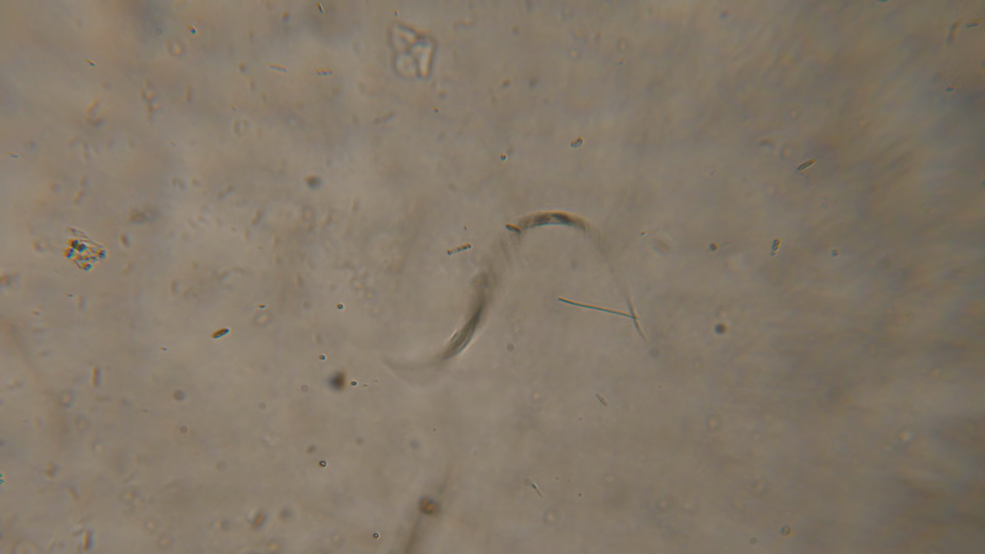 Bacteria Parasites Worms In Drinking Water Stock Footage SBV-353902228 ...