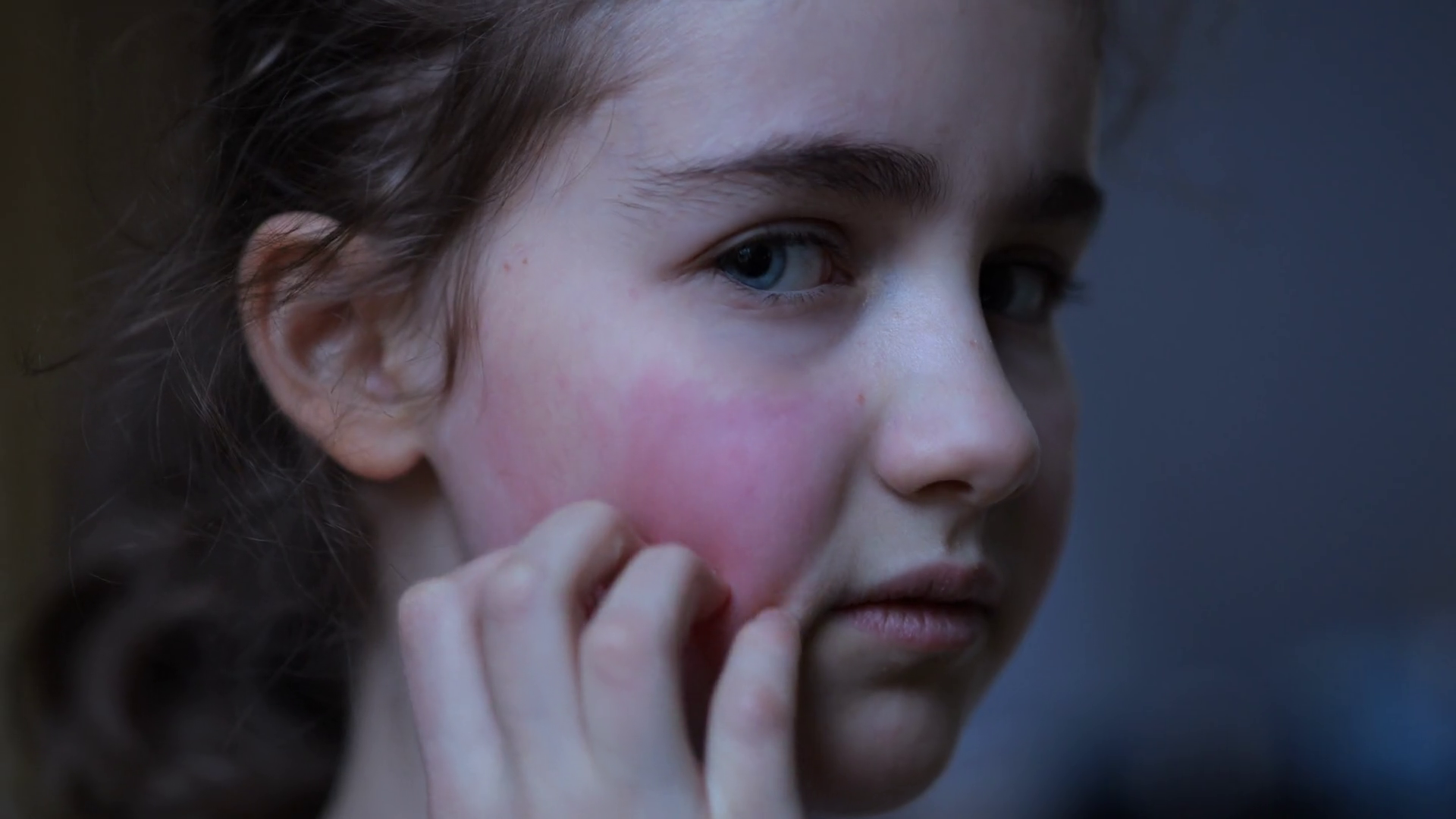 Girl Has Dry Red Skin Scratching Face Child Stock Footage SBV-352854724 ...