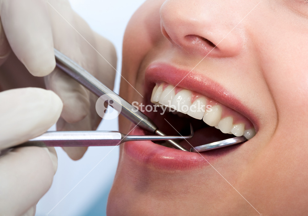 Closeup of patient's open mouth during oral inspection with mirror and